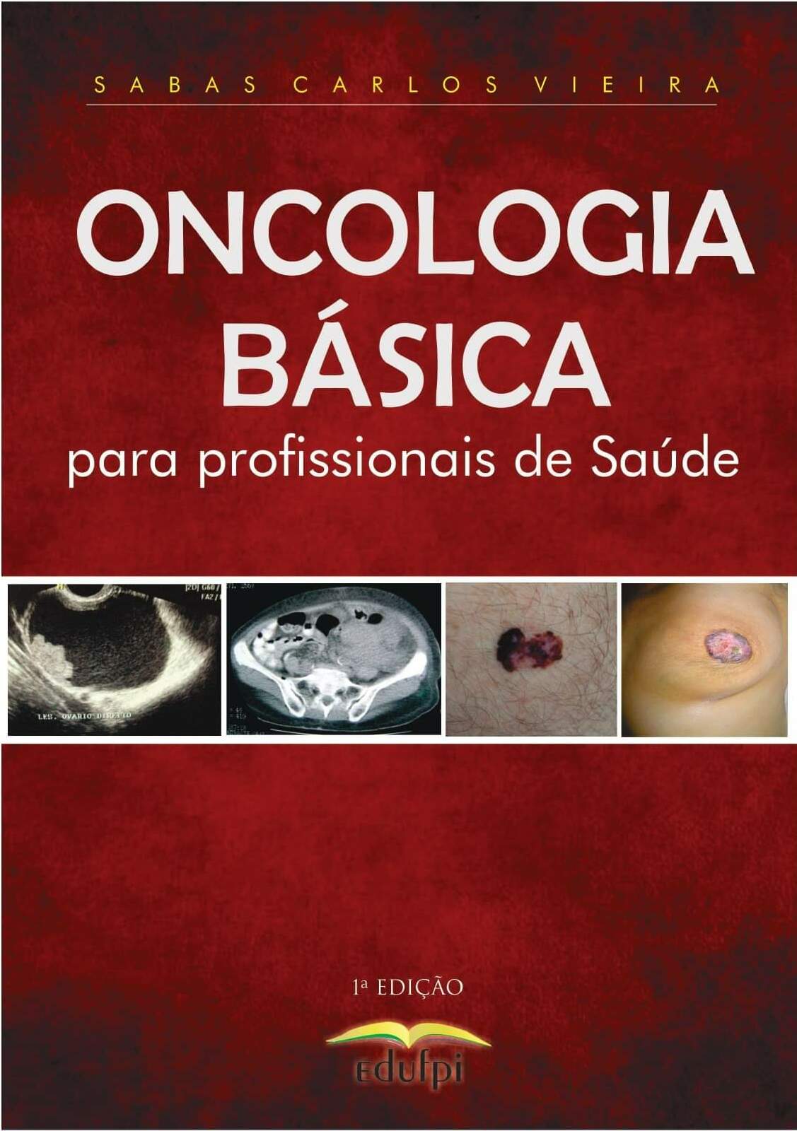 Oncologia básica para profissionais de saúde 1 ed PDF MeuLivro